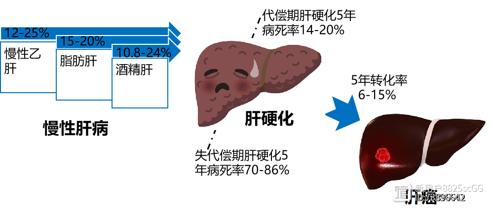 请问肝纤维化是什么病？一篇文章带你深入了解