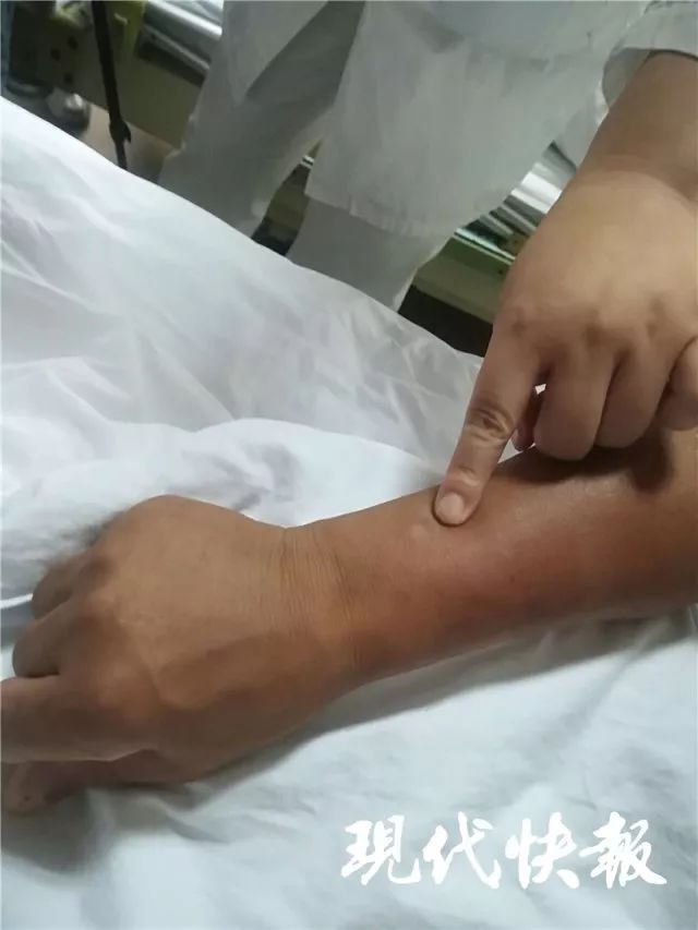 印度一医院2名新生儿被老鼠咬伤印度某医院发生新生儿被老鼠咬伤事件，深度分析与反思